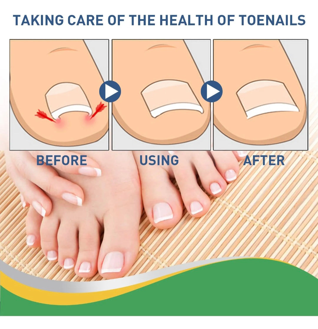 PARCHE UÑAS 50 UNIDADES
