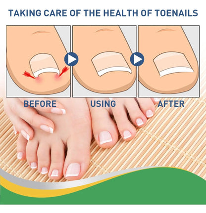 PARCHE UÑAS 50 UNIDADES