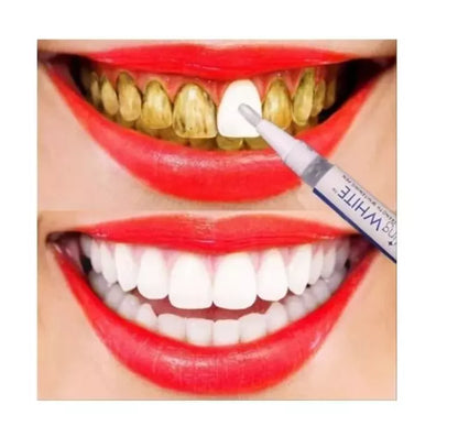 Lápiz Blanqueador Dental Profesional